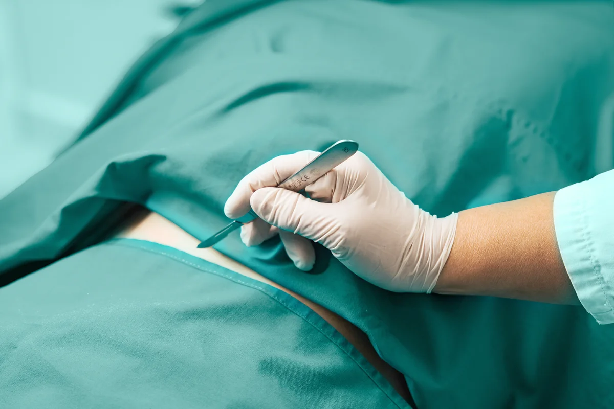 Plastična kirurgija